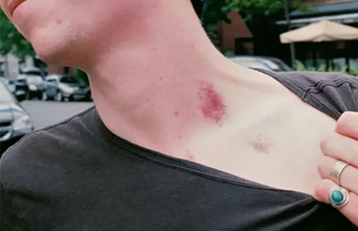 Julio Macias tuli pärast tüdruksõbraga aja veetmist koju õhtust sööma. Pere oli laua ääres istet võtmas, kui Juliot tabasid krambid ning pisut hiljem ta suri. Tema kaelal oli suur lilla „maasikana“ tuntud verevalum, mis osutus hiljem tema surma põhjustajaks.